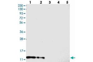 Western blot analysis of Lane 1: RT-4, Lane 2: U-251 MG, Lane 3: Human Plasma, Lane 4: Liver, Lane 5: Tonsil with C7orf59 polyclonal antibody  at 1:250-1:500 dilution. (LAMTOR4 antibody)