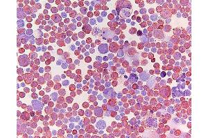 Immunohistochemistry (IHC) image for anti-ATP-Binding Cassette, Sub-Family C (CFTR/MRP), Member 5 (ABCC5) antibody (ABIN920695) (ABCC5 antibody)