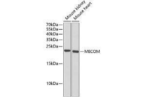 Western blot analysis of extracts of various cell lines, using MECOM antibody (ABIN6132516, ABIN6143677, ABIN6143679 and ABIN6221326) at 1:1000 dilution. (MECOM antibody  (AA 1-120))