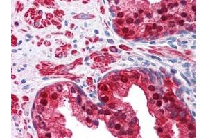 Human Prostate: Formalin-Fixed, Paraffin-Embedded (FFPE) (Isocitrate Dehydrogenase antibody)
