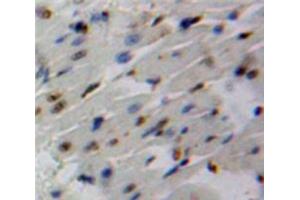 Used in DAB staining on fromalin fixed paraffin-embedded Heart tissue (SMAD6 antibody  (AA 116-364))