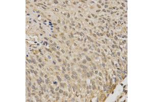 Immunohistochemistry (IHC) image for anti-serine/threonine Kinase 11 (STK11) (AA 134-433) antibody (ABIN3022973) (LKB1 antibody  (AA 134-433))