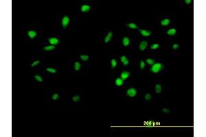 Immunofluorescence of purified MaxPab antibody to CUL4B on HeLa cell. (Cullin 4B antibody  (AA 1-913))