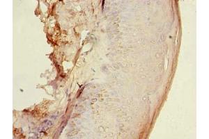 Immunohistochemistry of paraffin-embedded human skin tissue using ABIN7154963 at dilution of 1:100 (HEMK1 antibody  (AA 1-338))