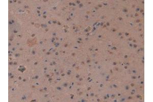 IHC-P analysis of Mouse Cerebrum Tissue, with DAB staining. (MT3 antibody  (AA 1-68))