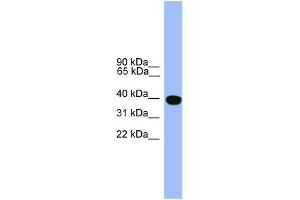 WB Suggested Anti-SERPINA1 Antibody Titration: 0. (SERPINA1 antibody  (C-Term))