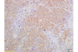 Formalin-fixed and paraffin embedded mouse lymphoma labeled with Rabbit Anti IL-27R/TCCR Polyclonal Antibody, Unconjugated (ABIN749498) at 1:200 followed by conjugation to the secondary antibody and DAB staining