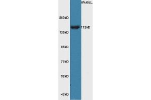 Lane 1:A549 cell lysates probed with Rabbit Anti-RERE Polyclonal Antibody, Unconjugated (ABIN872454) at 1:300 overnight at 4 °C. (RERE antibody  (AA 521-620))