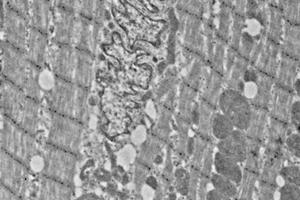 Immunoelectron microscopy analysis of LR white resin-embedded mouse heart using alpha Actinin 2 (ABIN7075510) at dilution of 1: 50. (Sarcomeric alpha Actinin antibody)
