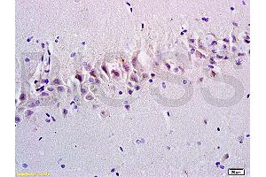 Formalin-fixed and paraffin embedded rat brain tissue labeled with Anti-Emp1/MUC1 Polyclonal Antibody, Unconjugated at 1:200, followed by conjugation to the secondary antibody and DAB staining (EMP1 antibody  (AA 101-160))