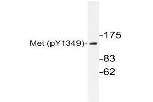 Western blot (WB) analyzes of p-Met antibody in extracts from HepG2 cells.