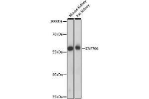 Western blot analysis of extracts of various cell lines, using ZNF766 antibody (ABIN7271530) at 1000 dilution. (ZNF766 antibody  (AA 60-190))