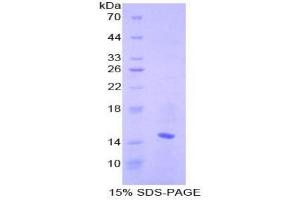 SDS-PAGE analysis of Mouse CCL6 Protein.