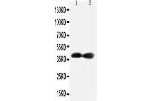Anti-Cdk7 antibody, Western blotting Lane 1: Rat Testis Tissue Lysate Lane 2: Rat Ovary Tissue Lysate (CDK7 antibody  (C-Term))