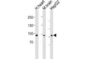 All lanes : Anti-PROX1 Antibody (Center) at 1:1000 dilution Lane 1: human heart lysates Lane 2: mouse brain lysates Lane 3: HepG2 whole cell lysates Lysates/proteins at 20 μg per lane. (PROX1 antibody  (AA 444-478))