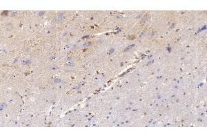 Detection of MMP2 in Human Cerebrum Tissue using Polyclonal Antibody to Matrix Metalloproteinase 2 (MMP2) (MMP2 antibody  (AA 110-660))