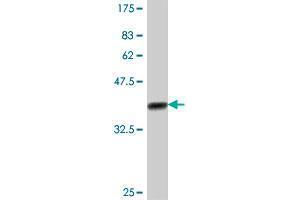 Western Blot detection against Immunogen (37. (AKAP11 antibody  (AA 1801-1901))