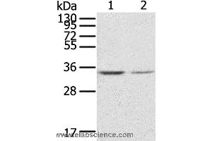 Western blot analysis of NIH/3T3 and Jurkat cell, using GNB2L1 Polyclonal Antibody at dilution of 1:300 (GNB2L1 antibody)