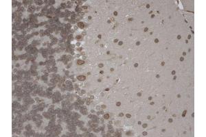Immunohistochemistry analysis using Mouse Anti-TrpM7 Monoclonal Antibody, Clone S74-25 . (TRPM7 antibody  (AA 1817-1863) (FITC))