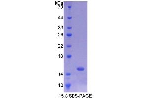 SDS-PAGE (SDS) image for BCL2 Binding Component 3 (BBC3) (AA 76-170) protein (His tag) (ABIN1878696)