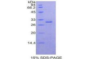 SDS-PAGE analysis of Human RORa Protein. (RORA Protein)