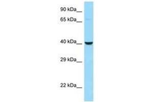 Image no. 1 for anti-Cathepsin E (CTSE) (AA 31-80) antibody (ABIN6748052) (Cathepsin E antibody  (AA 31-80))