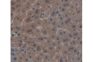 Used in DAB staining on fromalin fixed paraffin- embedded liver tissue (NR1I3 antibody  (AA 1-247))