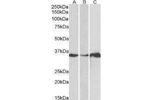 ABIN184658 (1µg/ml) staining of Human Cerebellum (A), Colon (B) and Duodenum (C) lysate (35µg protein in RIPA buffer). (LASP1 antibody  (N-Term))