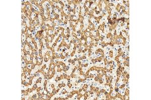 IHC analysis of IGF1 using anti-IGF1 antibody (ABIN7601895).