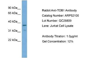 WB Suggested Anti-TOB1  Antibody Titration: 0. (Protein Tob1 (TOB1) (Middle Region) antibody)