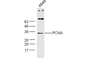 A549 lysates probed with PCNA Polyclonal Antibody, Unconjugated  at 1:300 dilution and 4˚C overnight incubation. (PCNA antibody  (AA 185-261))
