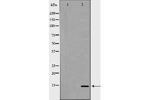 Western blot analysis of K562 whole cell lysates, using GYPC Antibody. (CD236/GYPC antibody  (Internal Region))