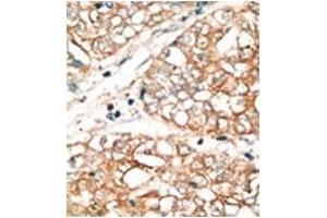 Image no. 2 for anti-BCL2-Related Ovarian Killer (BOK) (BH3 Domain), (N-Term) antibody (ABIN356820) (BOK antibody  (BH3 Domain, N-Term))