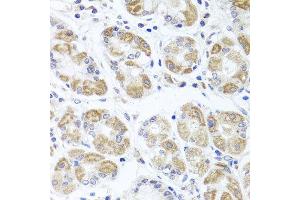 Immunohistochemistry of paraffin-embedded human stomach using ACP1 antibody at dilution of 1:100 (x40 lens). (ACP1 antibody)