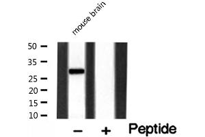 Western blot analysis of MMP7 expression in Mouse brain lysate (MMP7 antibody  (C-Term))