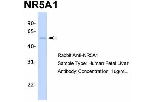 Host:  Rabbit  Target Name:  NR5A1  Sample Type:  Human Fetal Liver  Antibody Dilution:  1. (NR5A1 antibody  (Middle Region))