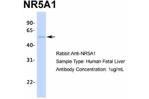 Host:  Rabbit  Target Name:  NR5A1  Sample Type:  Human Fetal Liver  Antibody Dilution:  1.