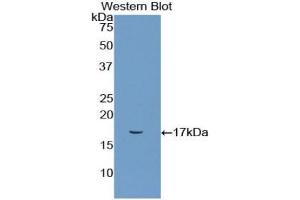Detection of Recombinant CD72, Rat using Polyclonal Antibody to Cluster Of Differentiation 72 (CD72) (CD72 antibody  (AA 126-237))