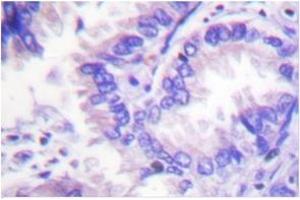 Image no. 1 for anti-Protein Phosphatase 2, Catalytic Subunit, alpha Isozyme (PPP2CA) antibody (ABIN272071) (PPP2CA antibody)