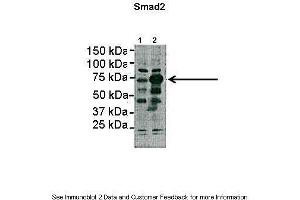 Lanes:   Lane1: 2ug HEK293lysate Lane2: 2ug SMAD2 transfected HEK293 lysate  Primary Antibody Dilution:   1:1000  Secondary Antibody:   Anti-rabbit HRP  Secondary Antibody Dilution:   1:5000  Gene Name:   SMAD2  Submitted by:   Dominique Alfandari, University of Massachusetts (SMAD2 antibody  (N-Term))