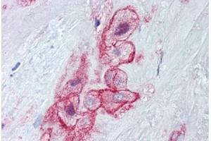 Human Placenta (formalin-fixed, paraffin-embedded) stained with MCAM antibody ABIN462314 followed by biotinylated goat anti-rabbit IgG secondary antibody ABIN481713, alkaline phosphatase-streptavidin and chromogen. (MCAM antibody  (Tyr641))