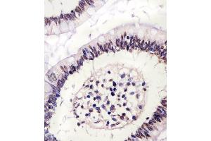 (ABIN6243085 and ABIN6578223) staining CTCF in human colon tissue sections by Immunohistochemistry (IHC-P - paraformaldehyde-fixed, paraffin-embedded sections). (CTCF antibody  (AA 334-364))