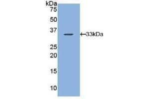 Detection of Recombinant ARRb1, Human using Polyclonal Antibody to Arrestin Beta 1 (ARRb1) (beta Arrestin 1 antibody  (AA 3-246))