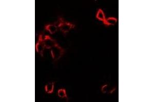 Immunofluorescent analysis of GFRA1 staining in SW480 cells. (GFRA1 antibody)