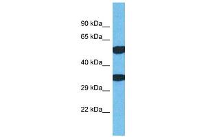 Host: Rabbit Target Name: TMEM68 Sample Type: Jurkat Whole Cell lysates Antibody Dilution: 1. (TMEM68 antibody  (N-Term))