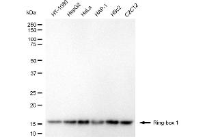 Western blotting analysis using ring-box 1 antibody (ABIN7800253).