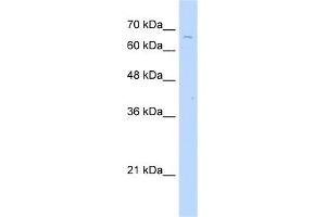 WB Suggested Anti-TKTL2 Antibody Titration:  2. (TKTL2 antibody  (C-Term))