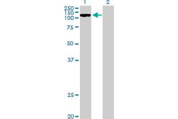 CCDC66 antibody  (AA 1-831)
