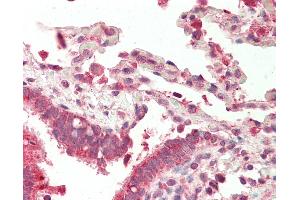 Human, Lung: Foramlin-Fixed Paraffin-Embedded (FFPE). (NFATC4 antibody  (N-Term))