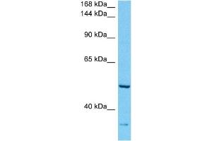 Host:  Rabbit  Target Name:  ABCA10  Sample Tissue:  Human Esophagus Tumor lysates  Antibody Dilution:  1ug/ml (ABCA10 antibody  (C-Term))